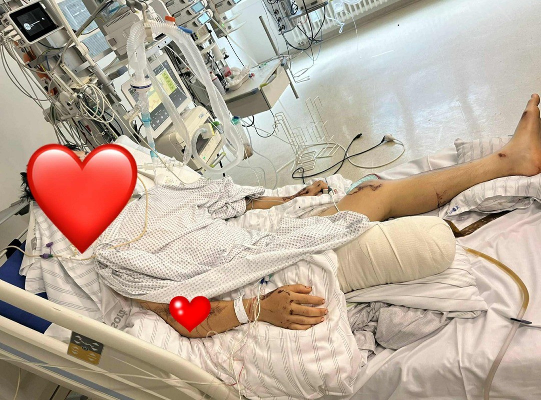 Tài xế ô tô sử dụng bóng cười đâm chết 2 du học sinh người Việt tại Đức